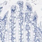 IMPG2 Antibody in Immunohistochemistry (IHC)