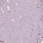 Sorcin Antibody in Immunohistochemistry (IHC)