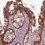 Sorcin Antibody in Immunohistochemistry (IHC)