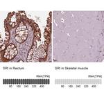 Sorcin Antibody