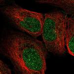 RRP4 Antibody in Immunocytochemistry (ICC/IF)