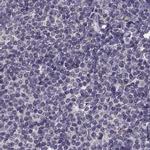 RP1L1 Antibody in Immunohistochemistry (IHC)