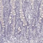 Cytokeratin 26 Antibody in Immunohistochemistry (IHC)