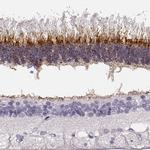 IMPG1 Antibody in Immunohistochemistry (IHC)