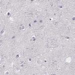 IMPG1 Antibody in Immunohistochemistry (IHC)