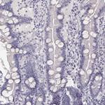 IMPG1 Antibody in Immunohistochemistry (IHC)