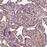 HTR1B Antibody in Immunohistochemistry (IHC)