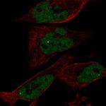 EYA1 Antibody in Immunocytochemistry (ICC/IF)