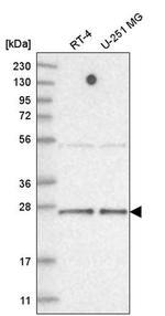 TAF11 Antibody in Western Blot (WB)