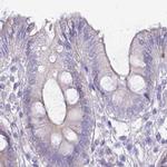 IMPG1 Antibody in Immunohistochemistry (IHC)