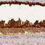 IMPG1 Antibody in Immunohistochemistry (IHC)