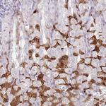 IMPG1 Antibody in Immunohistochemistry (IHC)