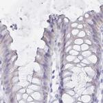 IMPG1 Antibody in Immunohistochemistry (IHC)