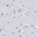 IMPG1 Antibody in Immunohistochemistry (IHC)