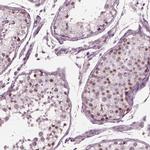 YY2 Antibody in Immunohistochemistry (IHC)