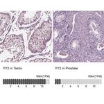 YY2 Antibody