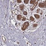 PALMD Antibody in Immunohistochemistry (IHC)