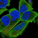 PALMD Antibody in Immunocytochemistry (ICC/IF)