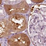 CRYM Antibody in Immunohistochemistry (IHC)