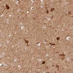 CRYM Antibody in Immunohistochemistry (IHC)