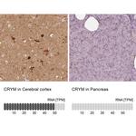 CRYM Antibody