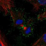 PSCA Antibody in Immunocytochemistry (ICC/IF)