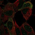 NCAM2 Antibody in Immunocytochemistry (ICC/IF)