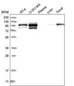 MCM4 Antibody in Western Blot (WB)