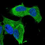 ZNF117 Antibody in Immunocytochemistry (ICC/IF)