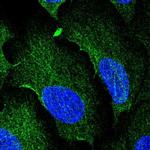 AAMP Antibody in Immunocytochemistry (ICC/IF)