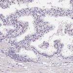 LCA5L Antibody in Immunohistochemistry (IHC)