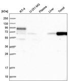 FBXO7 Antibody in Western Blot (WB)