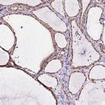 MYO5C Antibody in Immunohistochemistry (IHC)