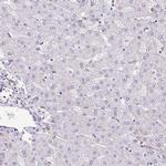 MYO5C Antibody in Immunohistochemistry (IHC)