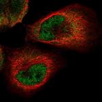 PACT Antibody in Immunocytochemistry (ICC/IF)