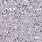 GRK1 Antibody in Immunohistochemistry (IHC)