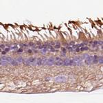 GRK1 Antibody in Immunohistochemistry (IHC)