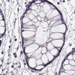 GRK1 Antibody in Immunohistochemistry (IHC)