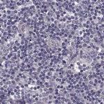 GRK1 Antibody in Immunohistochemistry (IHC)