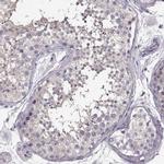 GRK1 Antibody in Immunohistochemistry (IHC)