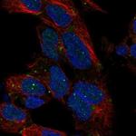 DLX1 Antibody in Immunocytochemistry (ICC/IF)