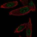 Gemin 6 Antibody in Immunocytochemistry (ICC/IF)