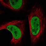 Synapsin 2 Antibody in Immunocytochemistry (ICC/IF)