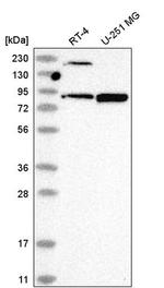 DDX50 Antibody in Western Blot (WB)