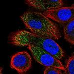 ABHD14A Antibody in Immunocytochemistry (ICC/IF)