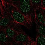 IFLTD1 Antibody in Immunocytochemistry (ICC/IF)