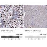 IKBIP Antibody in Immunohistochemistry (IHC)