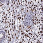 IKBIP Antibody in Immunohistochemistry (IHC)