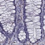 IKBIP Antibody in Immunohistochemistry (IHC)