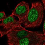 XRRA1 Antibody in Immunocytochemistry (ICC/IF)